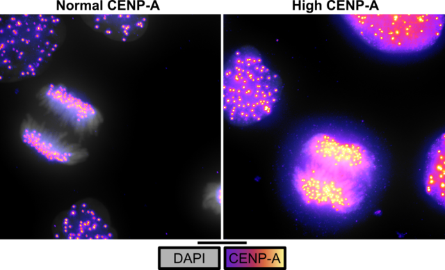 CENP-A overexpression in MCF10-2A cells, commonly used non-tumoural breast epithelial cells. Left panel: condensed dividing chromosomes with bright dots of CENP-A marking the centromeres. Right panel: upon induction of CENP-A overexpression, CENP-A is massively increased at the centromeres and also mis-incorporated all over the chromosome arms.